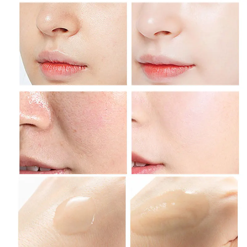 필링 세럼 살리실산 페이스 에센스 모공 수축, 여드름  - Niacinamide Pore Shrinking Essence 리뷰 및 가격